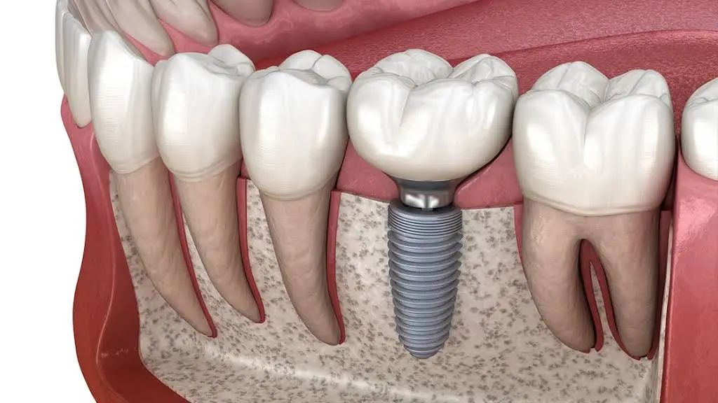 Crescent Family and Cosmetic Dentistry