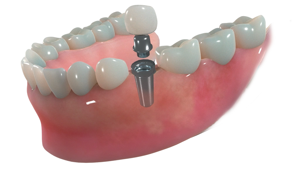 Crescent Family and Cosmetic Dentistry