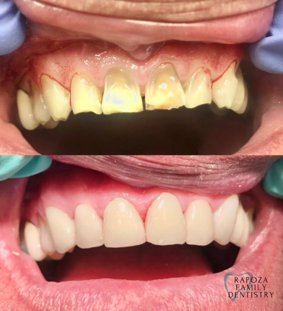 Rapoza Family Dentistry - Dr. Judee Hashem-Rapoza, DMD