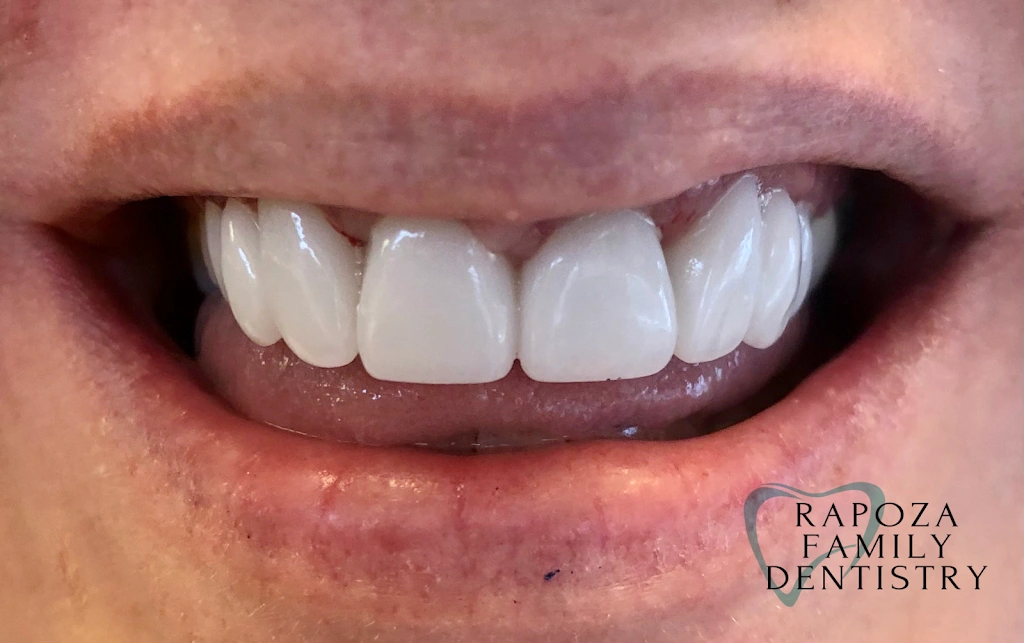 Rapoza Family Dentistry - Dr. Judee Hashem-Rapoza, DMD