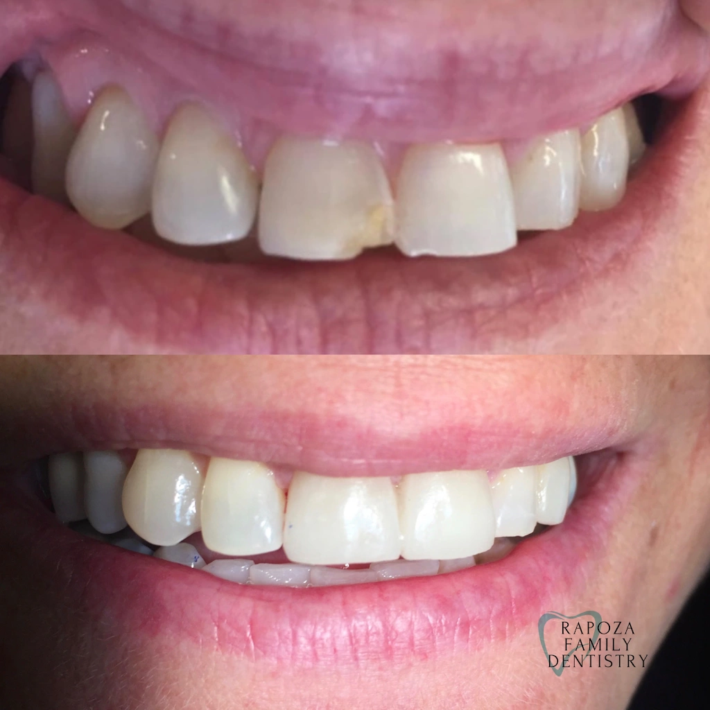 Rapoza Family Dentistry - Dr. Judee Hashem-Rapoza, DMD