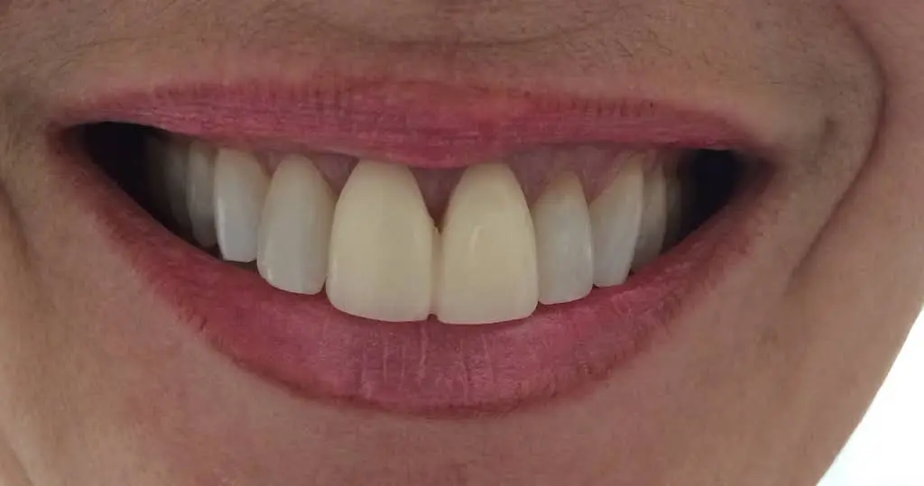 Main Line Dental Group