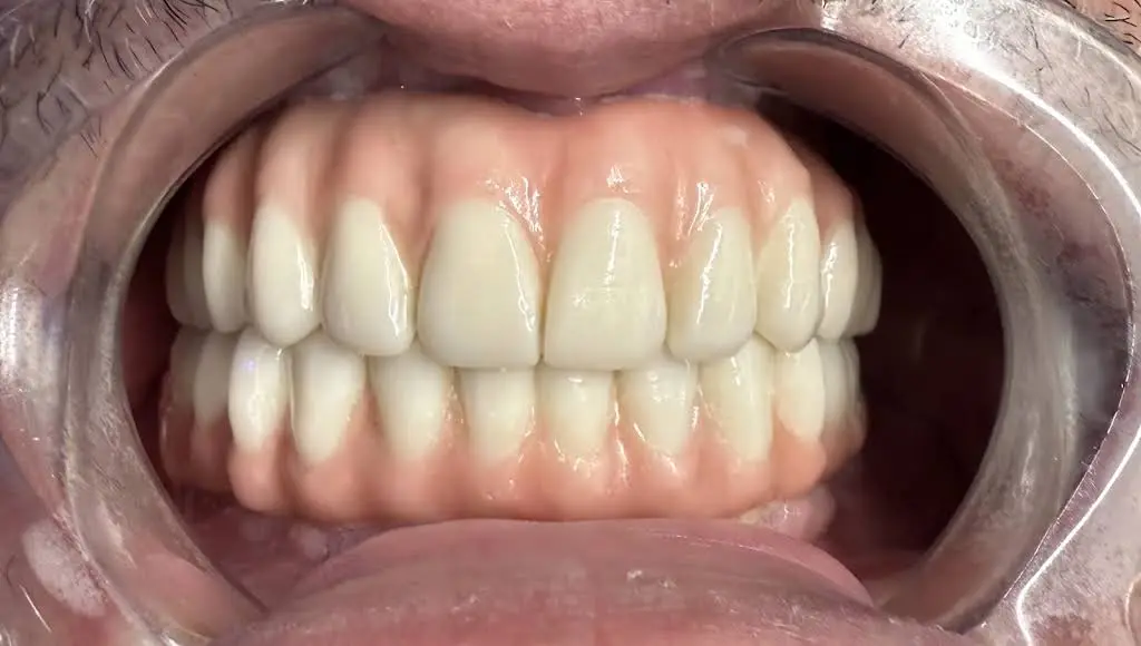 Silkmann DDS