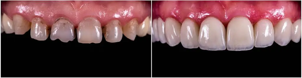 Eco Dental Implant Center
