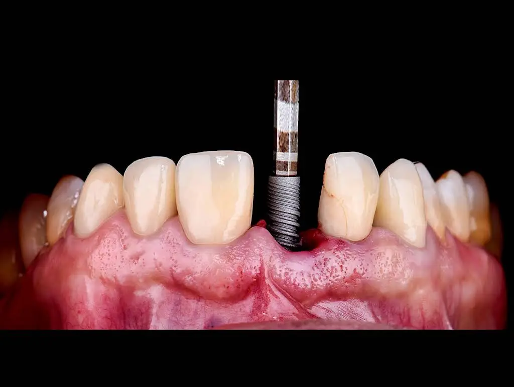 Eco Dental Implant Center