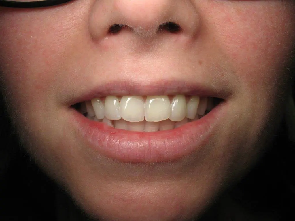 Vander Vliet Advanced Dental Care