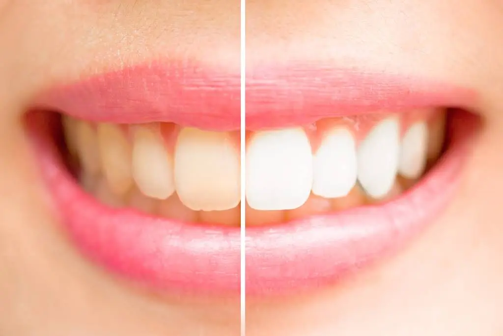 Diamond Dental Associates LLC