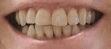 Plage Dentistry
