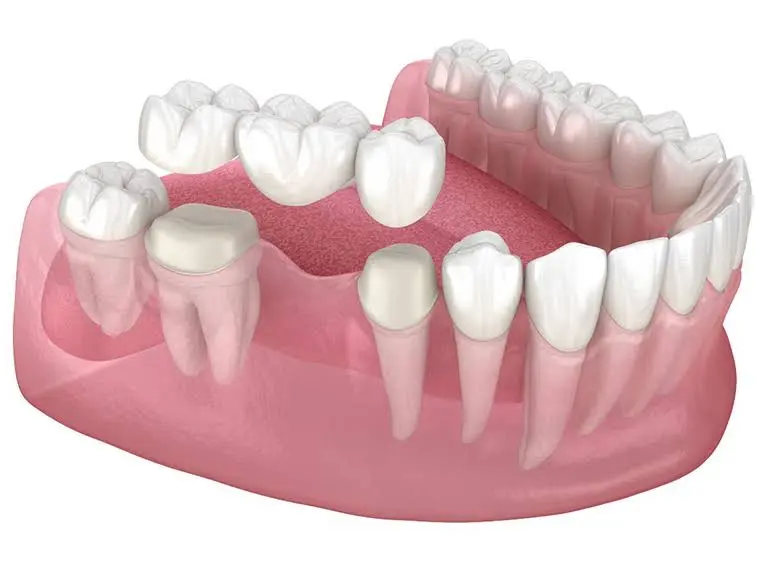 Crescent Family and Cosmetic Dentistry