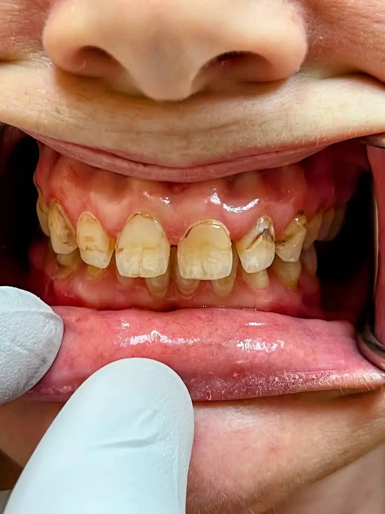 HaverCrown Dental