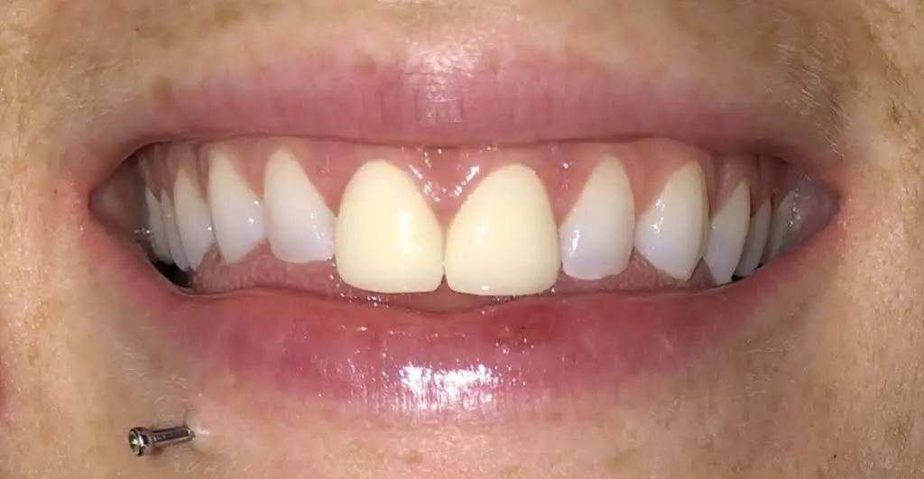 A+ Family Dental Care P.C.