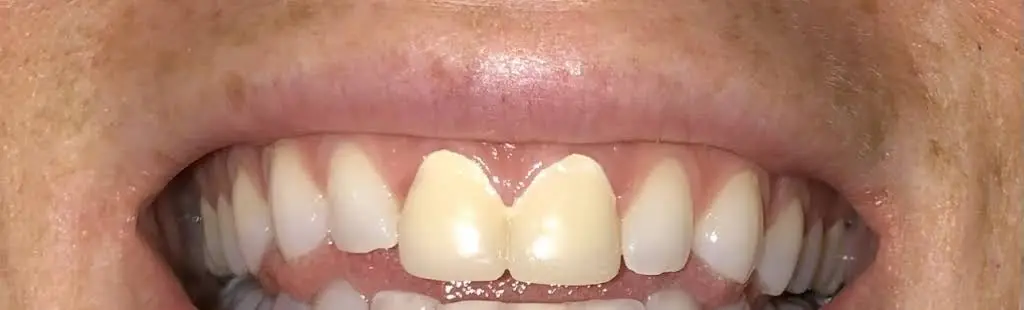 A+ Family Dental Care P.C.