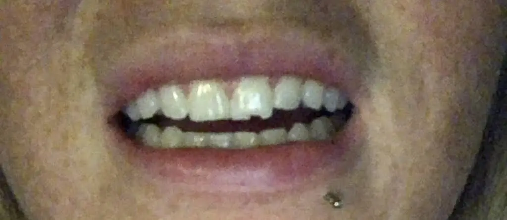 A+ Family Dental Care P.C.