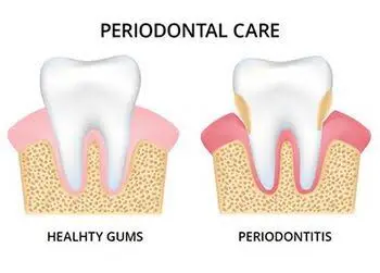 Lakeview Dental