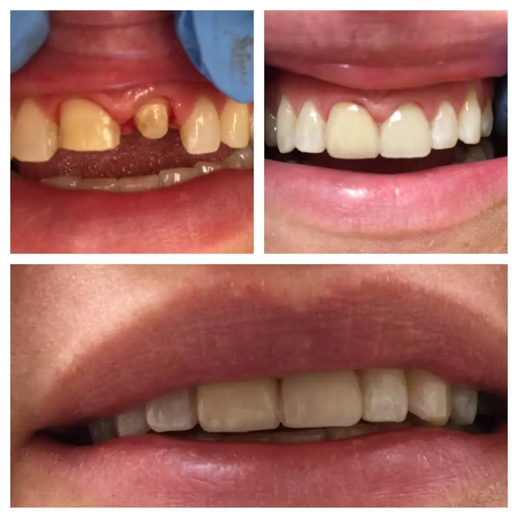 Readington Family Dental Care
