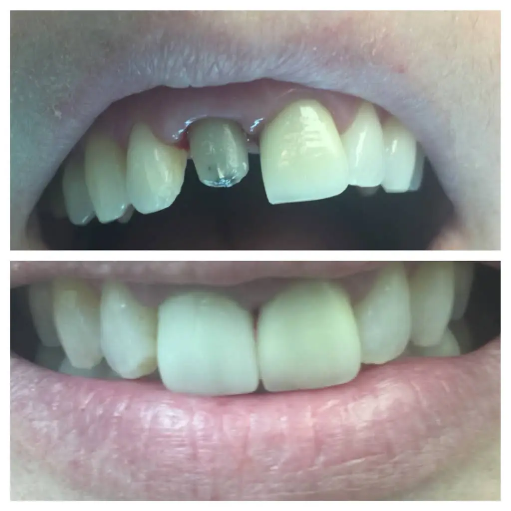 Readington Family Dental Care