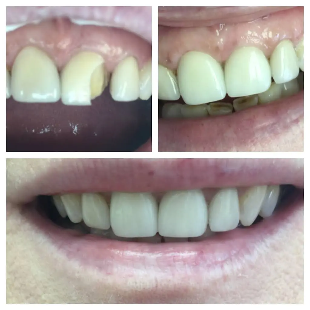 Readington Family Dental Care