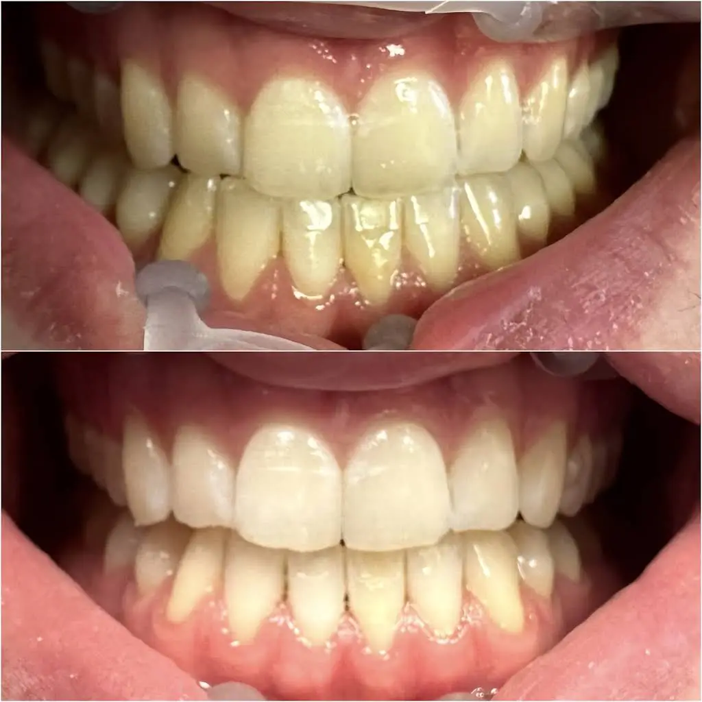 Abrams Family Dentistry