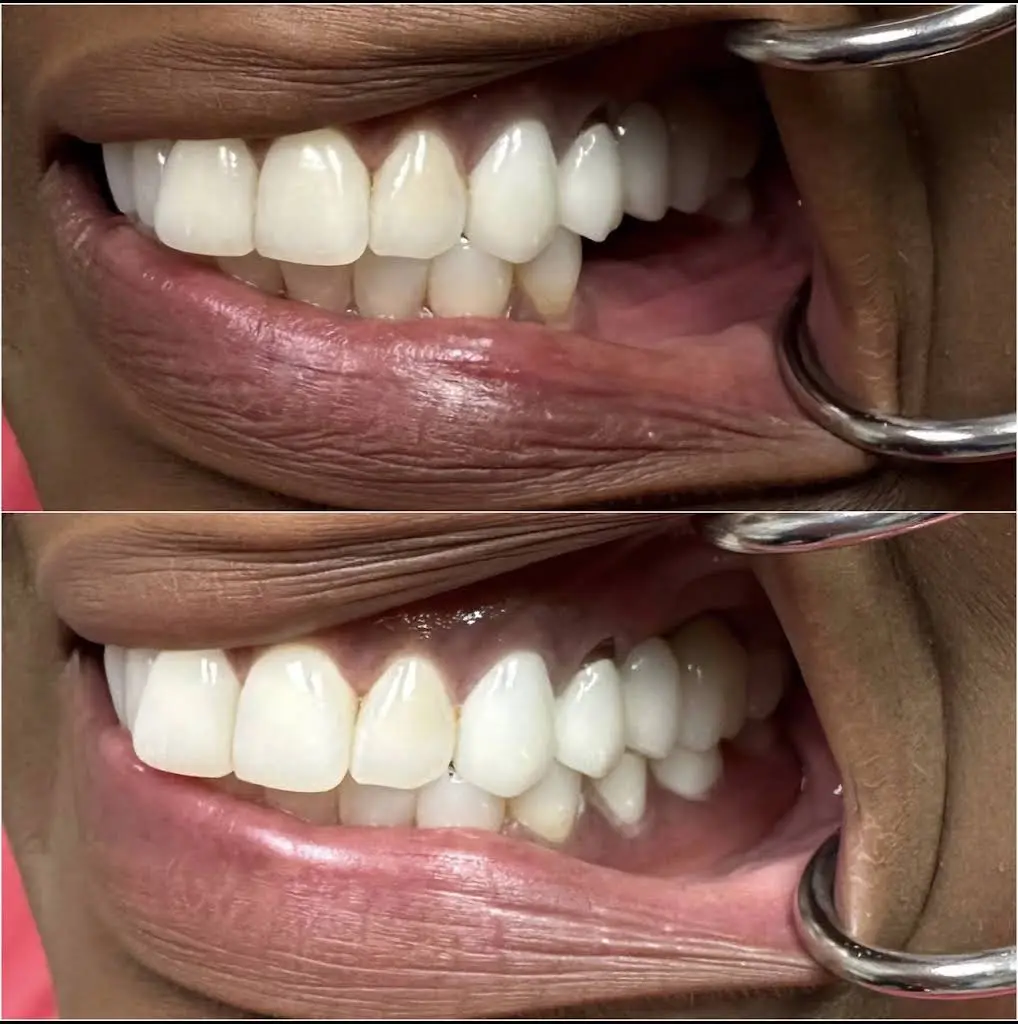 Abrams Family Dentistry