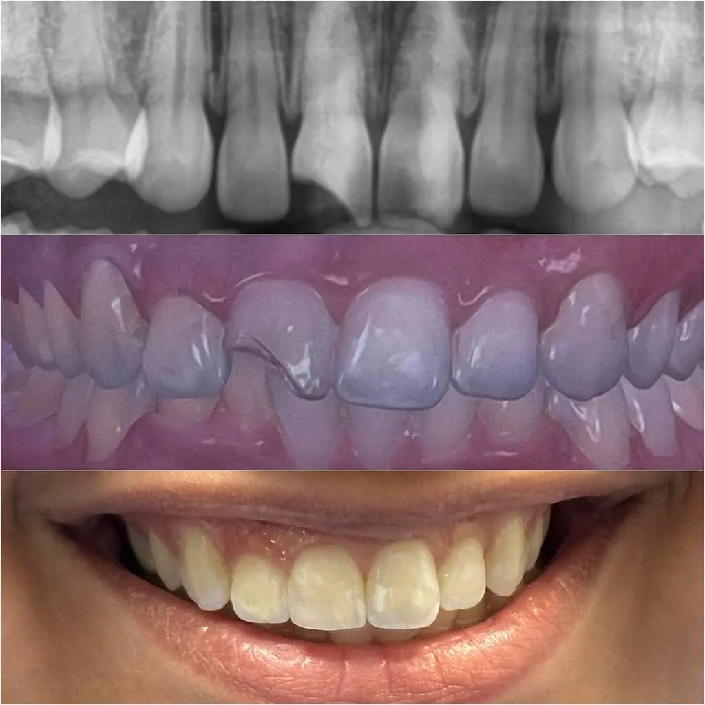 Abrams Family Dentistry