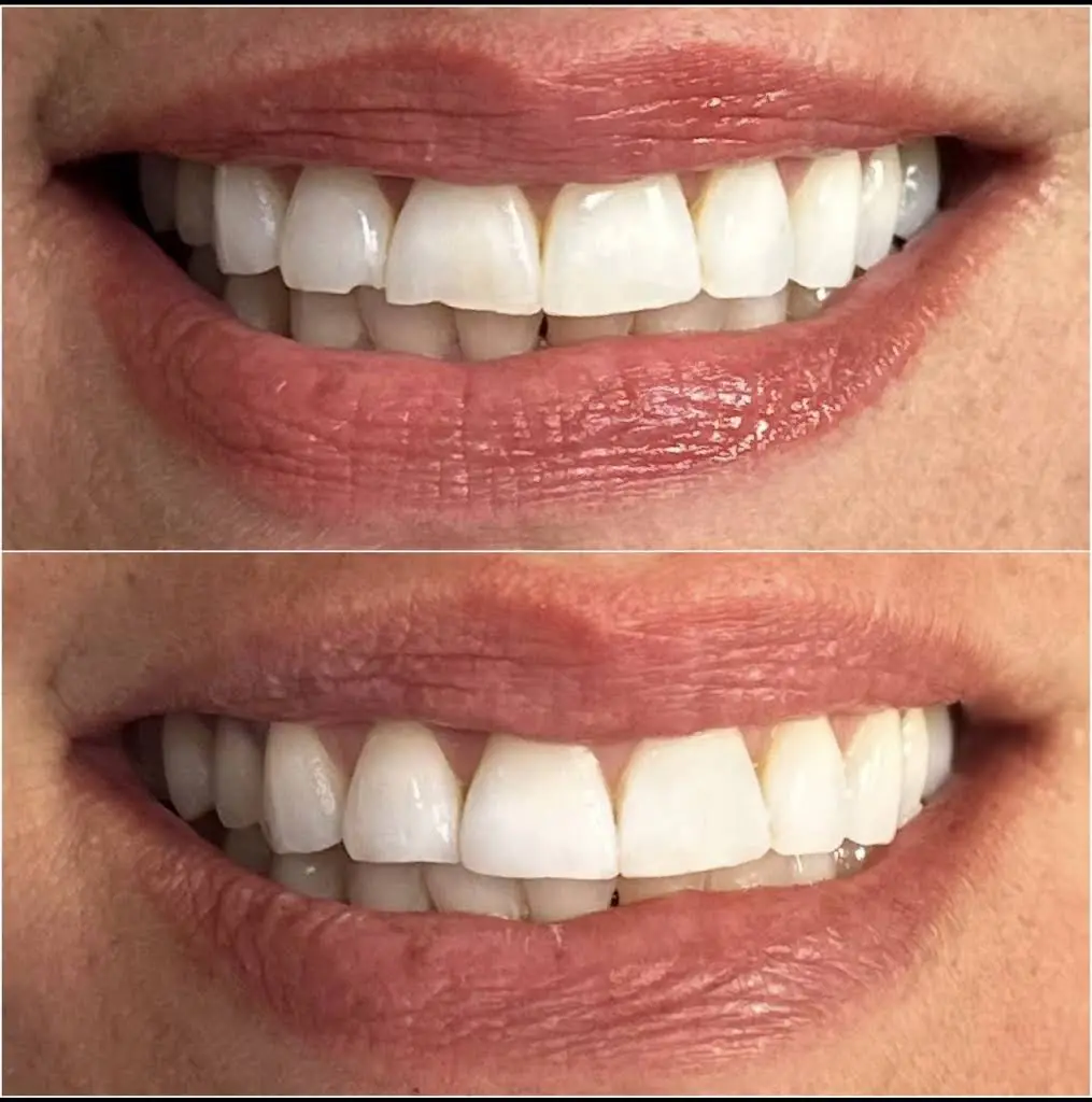 Abrams Family Dentistry
