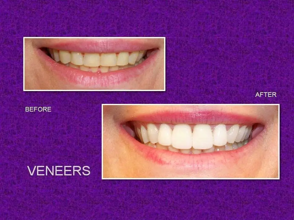 Timeless Smiles