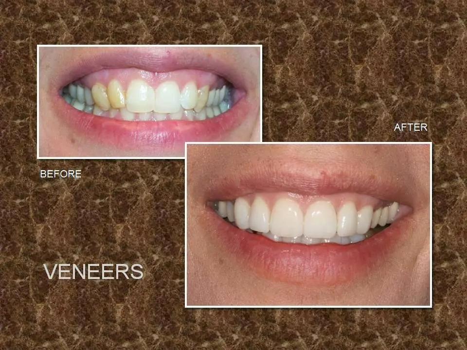 Timeless Smiles