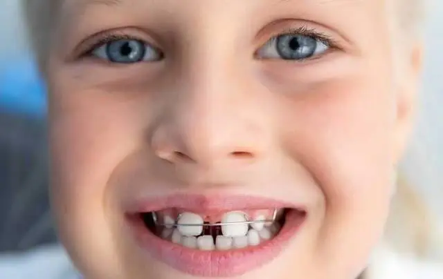 CDF Family Orthodontics
