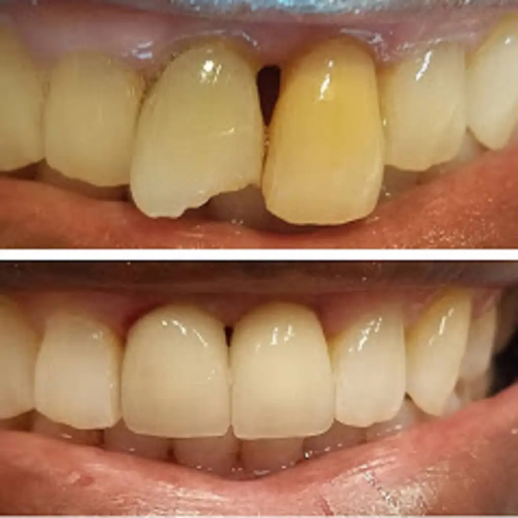 Access Dental Center - Implant Center