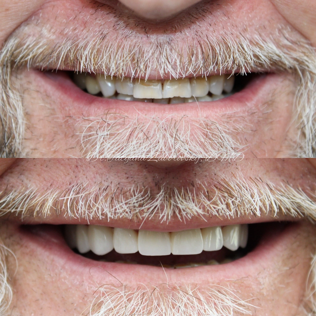 Bucks Mont Dental of North Wales