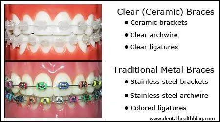 Duthie Orthodontics - Ithaca