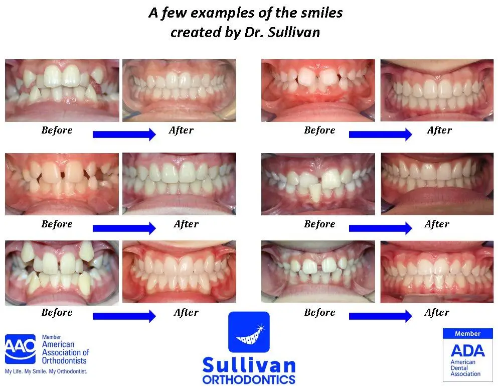 Sullivan Orthodontics