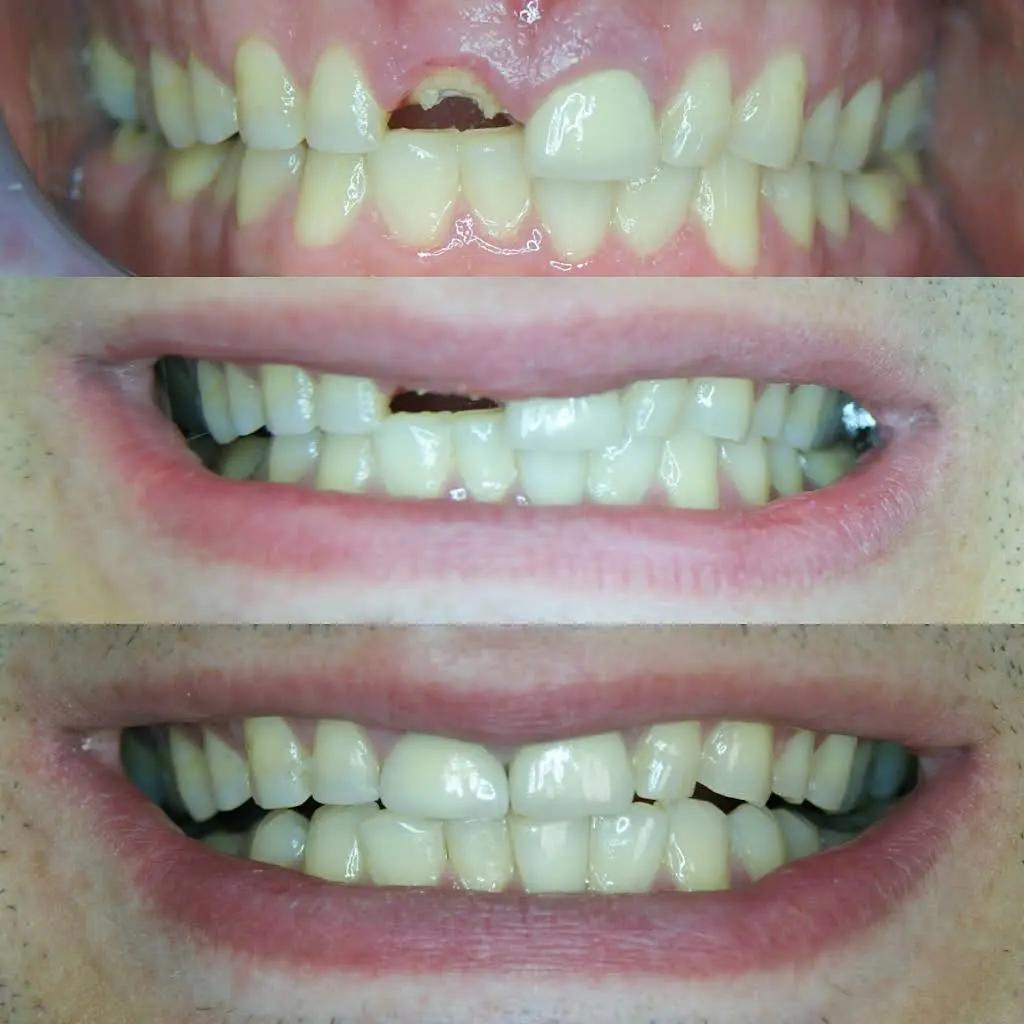 CrossKeys Dental