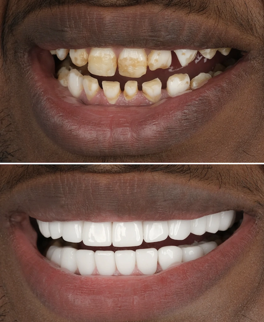 NÜVA Smile - Professional dental clinic exterior with modern facilities
