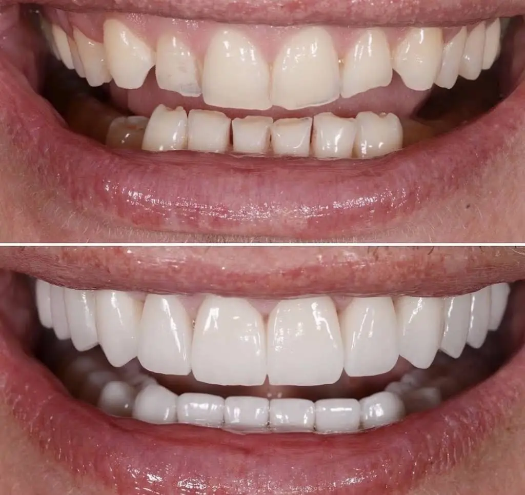 NÜVA Smile