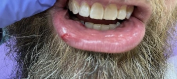 Richard Wilson D.D.S. Emergency Dentist