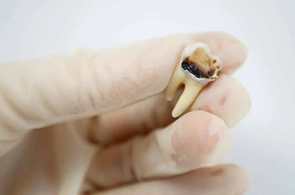 Crescent Family and Cosmetic Dentistry of Columbia