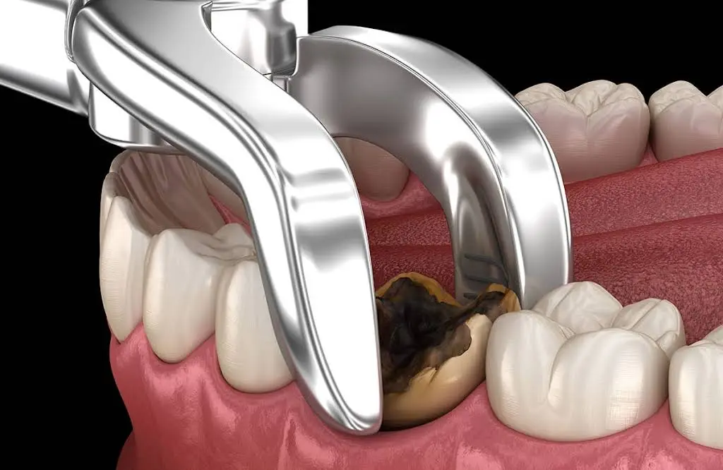 Crescent Family and Cosmetic Dentistry of Columbia