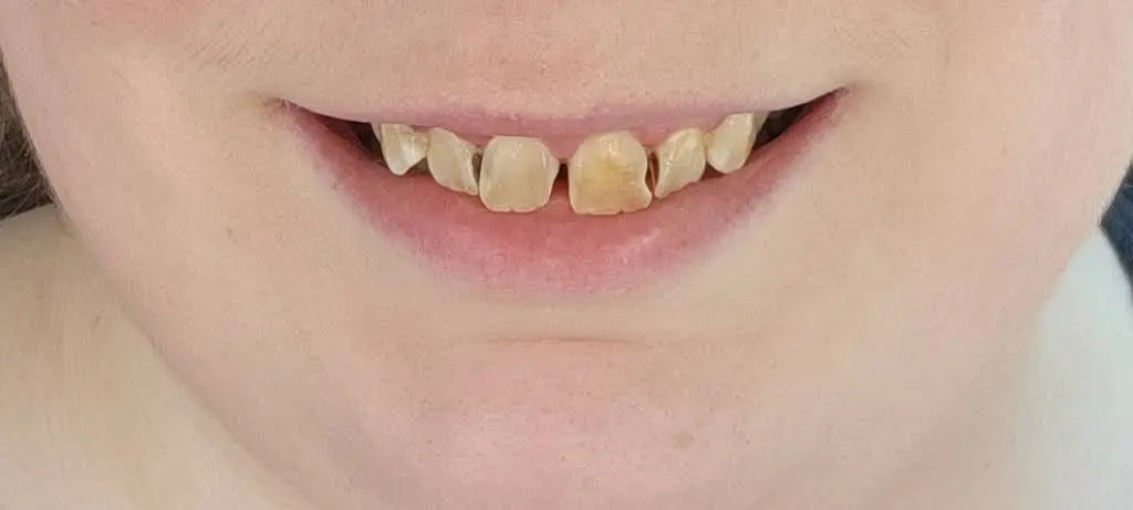 Ammons Dental by Design Summerville
