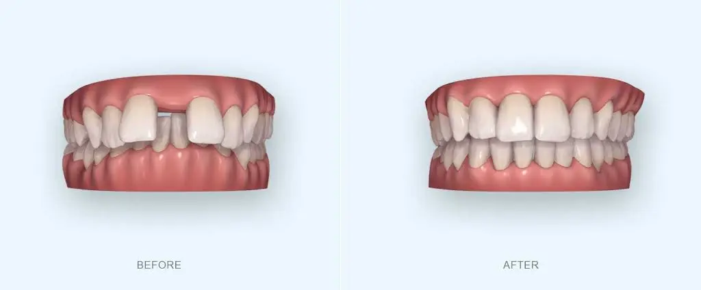 Acuity Dental & Orthodontics