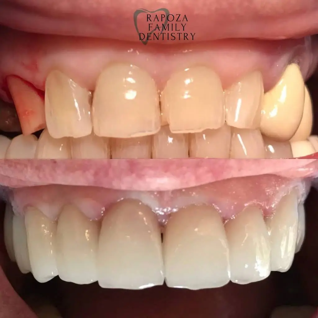Rapoza Family Dentistry