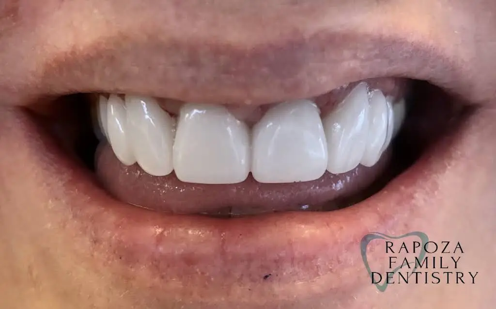 Rapoza Family Dentistry
