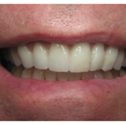 Ardmore Family & Cosmetic Dentistry: The Office of Dr. Bellisario
