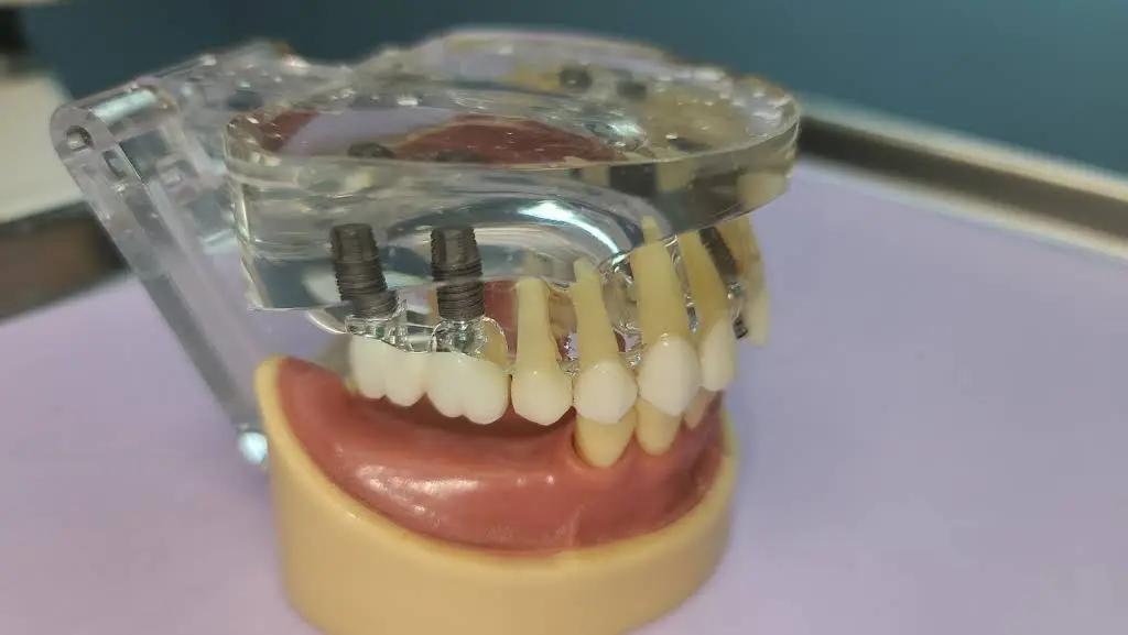 BLISS Dental Clinic