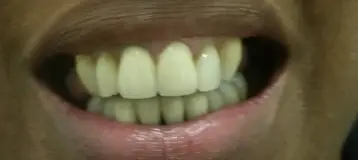 Smile Again Dental Lab