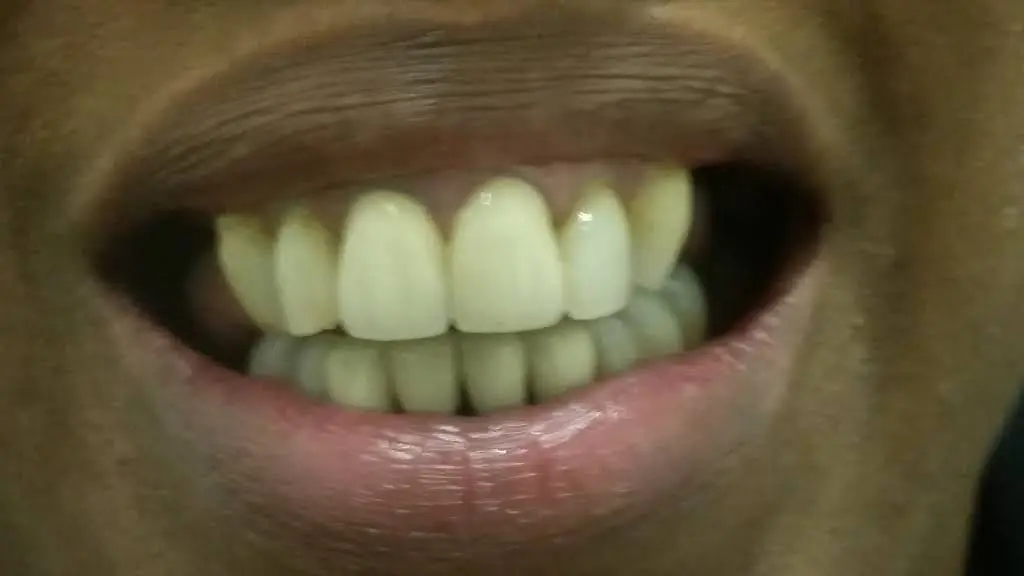 Smile Again Dental Lab - Professional dental clinic exterior with modern facilities