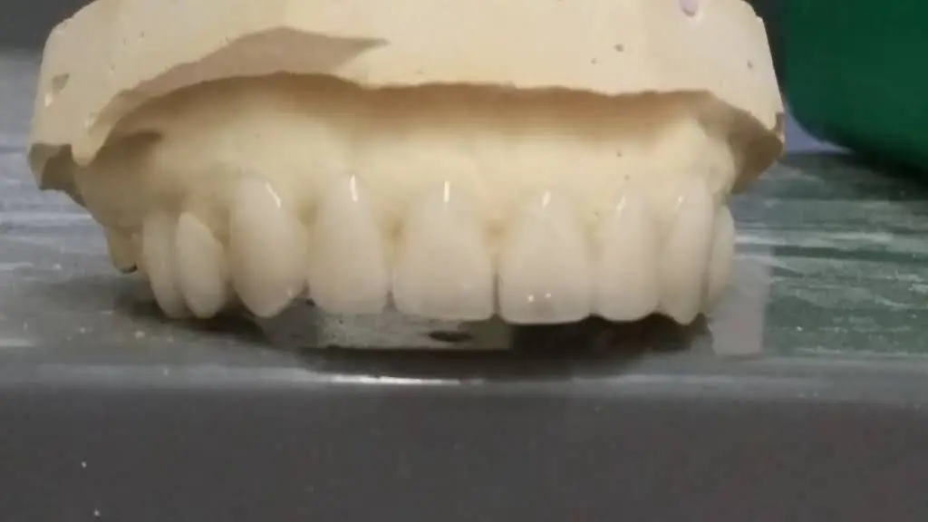 Smile Again Dental Lab
