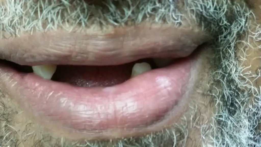 Smile Again Dental Lab