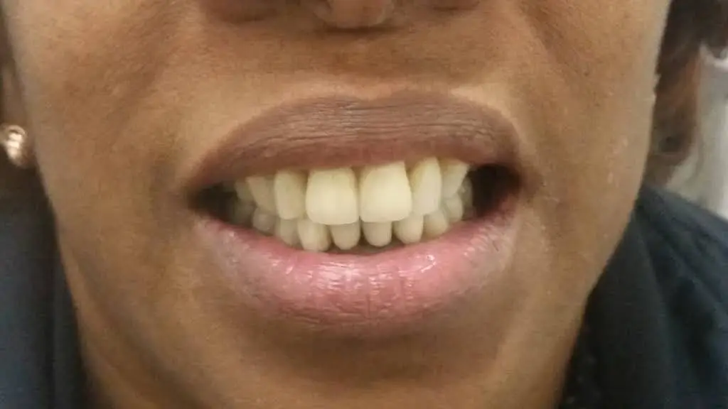 Smile Again Dental Lab