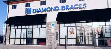 Diamond Braces